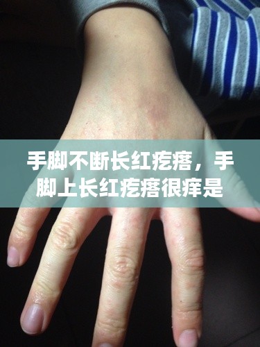 手脚不断长红疙瘩,手脚上长红疙瘩很痒是什么