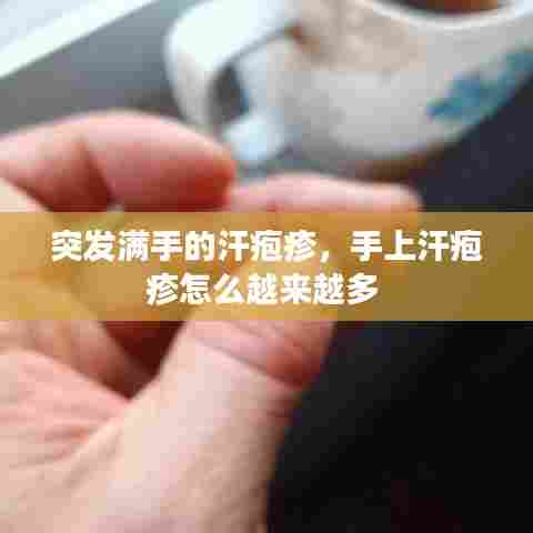 突发满手的汗疱疹,手上汗疱疹怎么越来越多