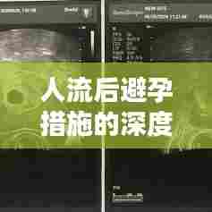 人流后避孕措施的深度探讨与实践