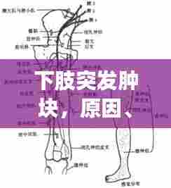下肢突发肿块，原因、诊断及有效治疗策略