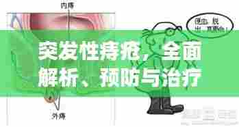 突发性痔疮,全面解析、预防与治疗策略